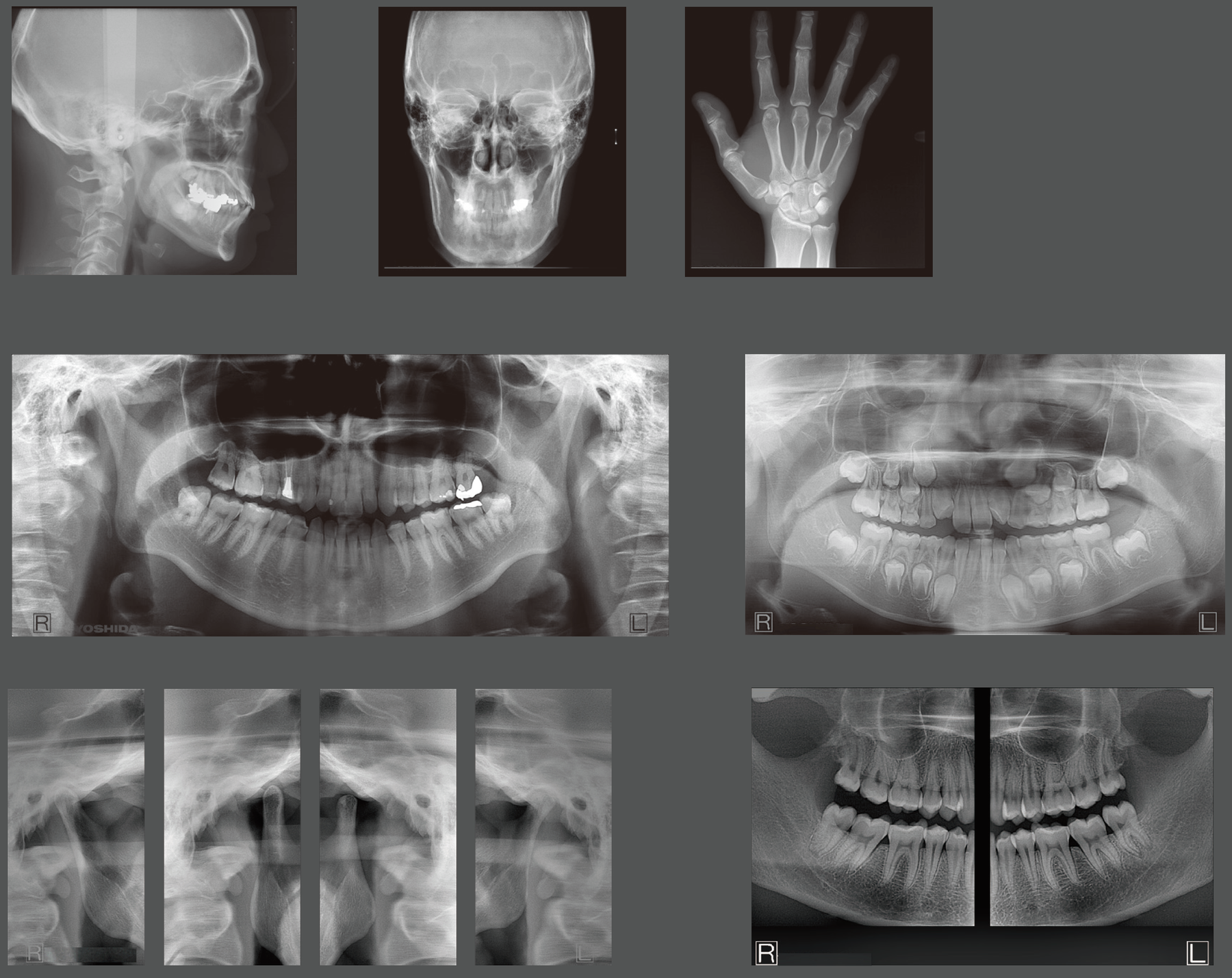 Panoura X-Era Panoramic & CBCT Imaging System